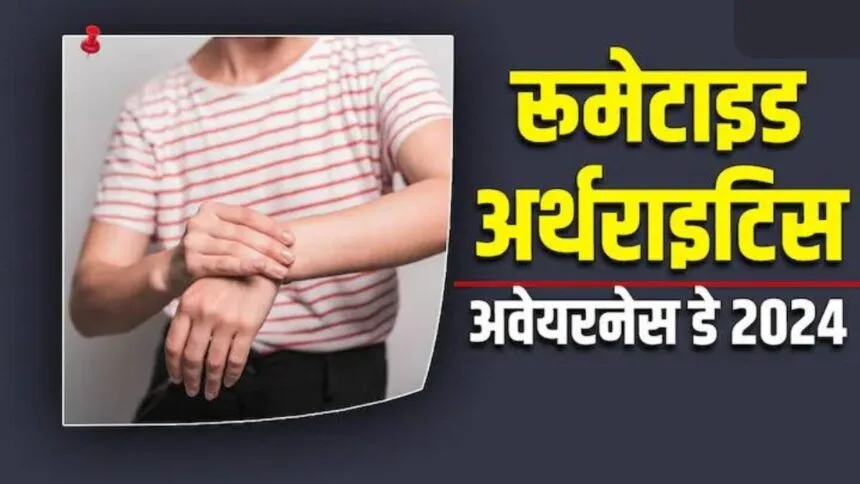 Rheumatoid Arthritis in Hindi